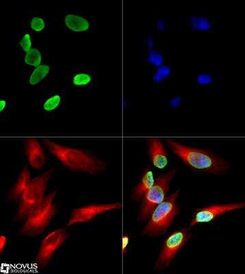 Immunocytochemistry/Immunofluorescence: Histone H4 [ac Lys12] Antibody [NB21-2064] - Tested at 1:10 in HeLa cells with DyLight 488 (green). Nuclei and alpha-tubulin were counterstained with DAPI (blue) and DyLight 550 (red). Image objective 40x.